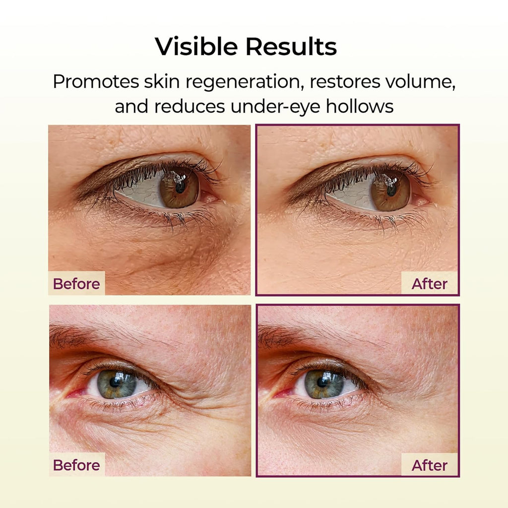 Calcium Boost Volume Repair Balm
