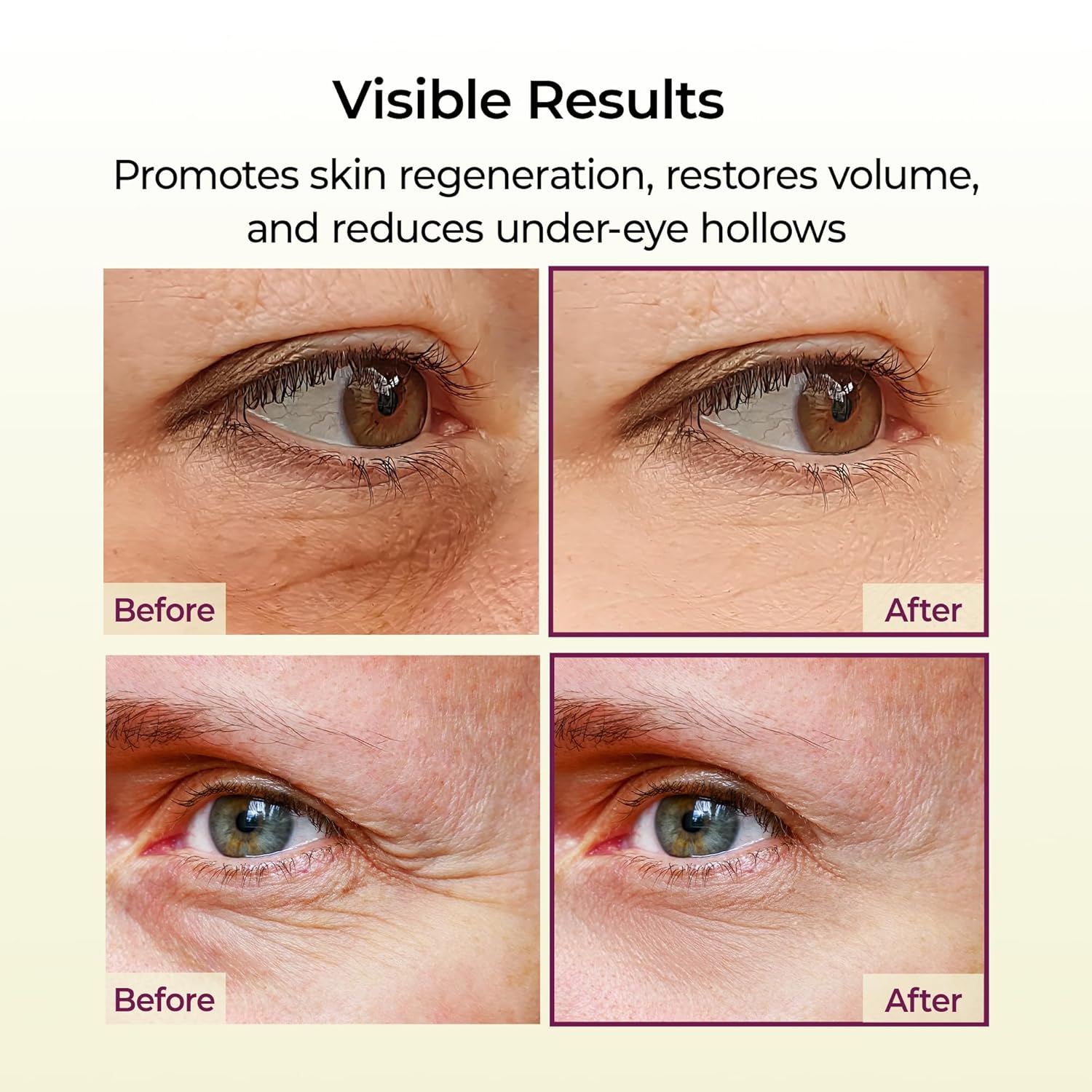Calcium Boost Volume Repair Balm